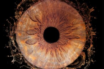 Iris 1 oeil