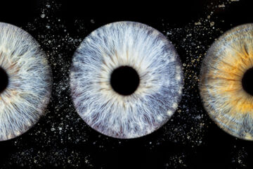 Iris 5 yeux